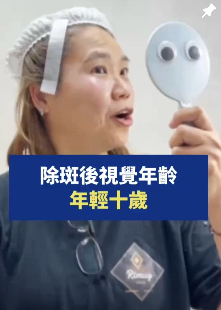 除斑後視覺年齡年輕十歲